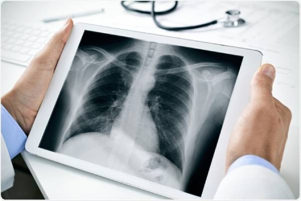 Digital X-Ray image on tablet used for orthopedic diagnosis