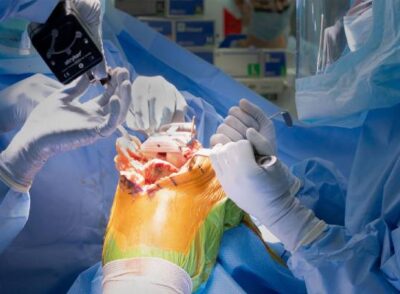 Surgeons performing Knee Replacement Surgery In PCMC Pune