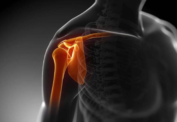 Illustration showing the shoulder joint highlighting injury and instability – Causes of Shoulder Dislocation explained