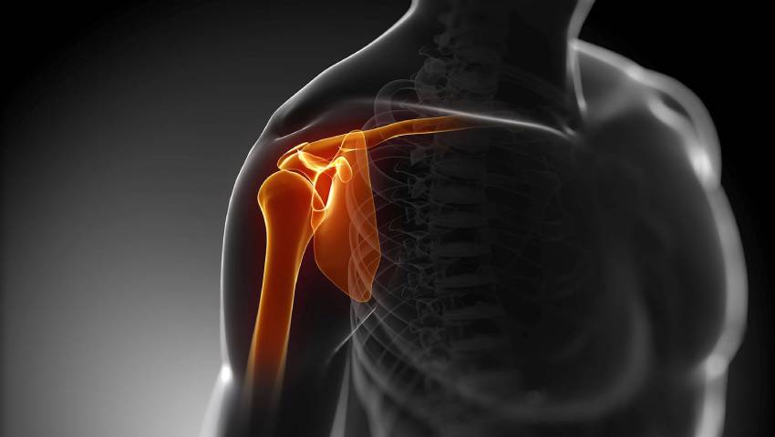 Illustration showing the shoulder joint highlighting injury and instability – Causes of Shoulder Dislocation explained