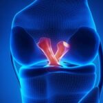 Everything You Need to Know About Ligament Surgery