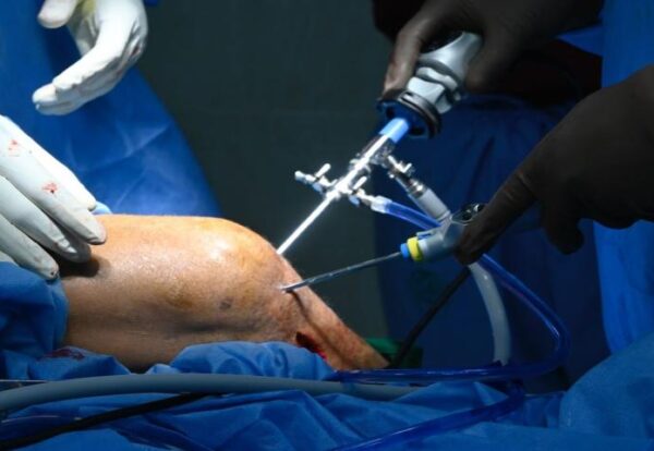 What Is Arthroscopic Knee Surgery Procedure, Recovery & Results