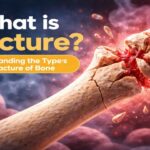 What is Fracture? Understanding the Types of Fracture of Bone